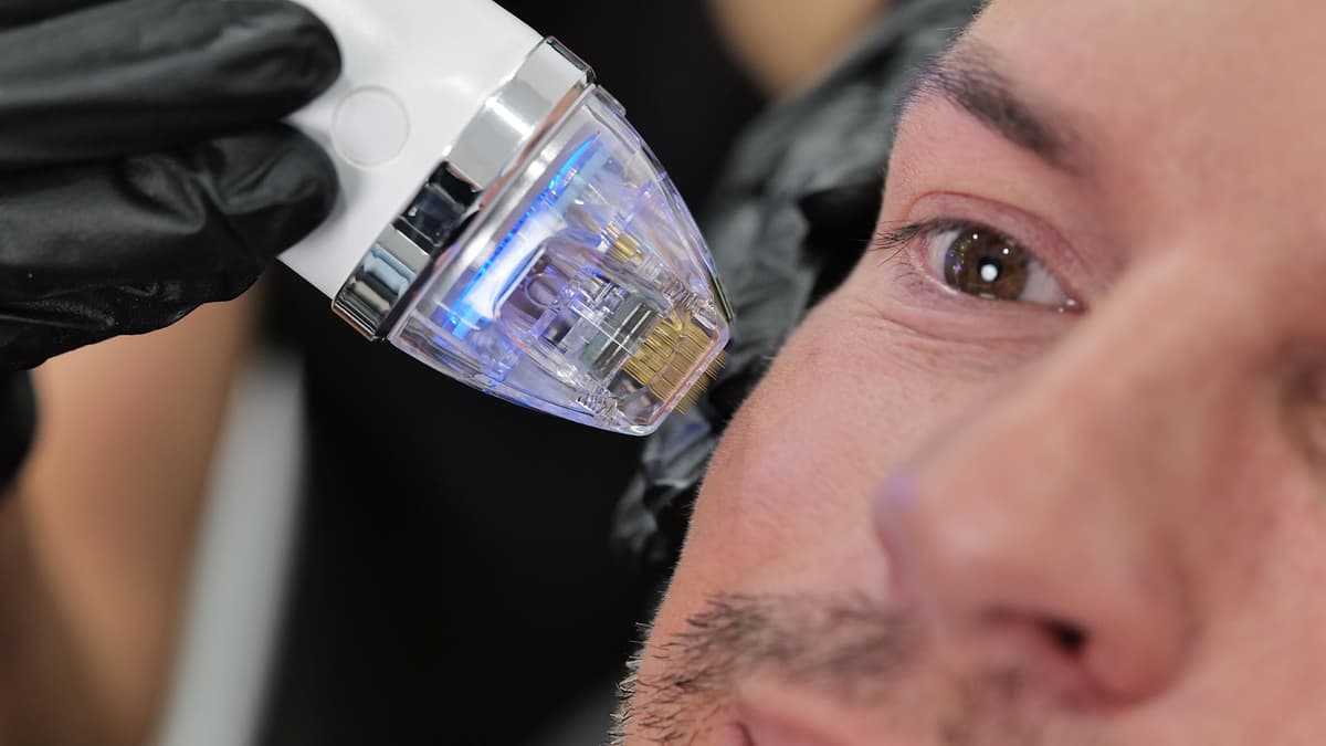 secret-rf-treatment