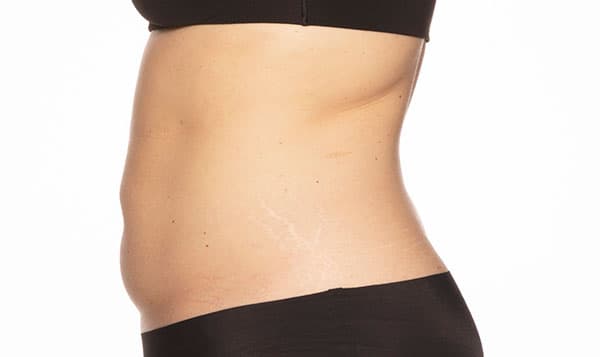 coolsculptingclinic-london