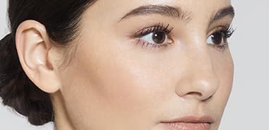 under-eye-filler-after
