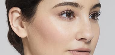 under-eye-filler-before