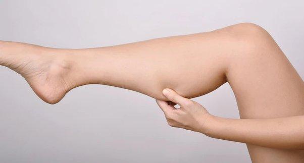 calf-slimming-skin-medical