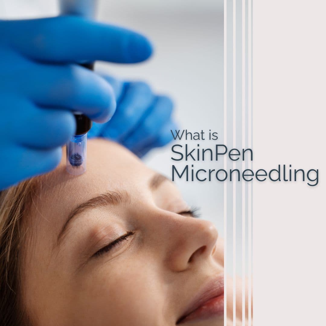SkinPen microneedling treatment for acne scars and skin texture improvement