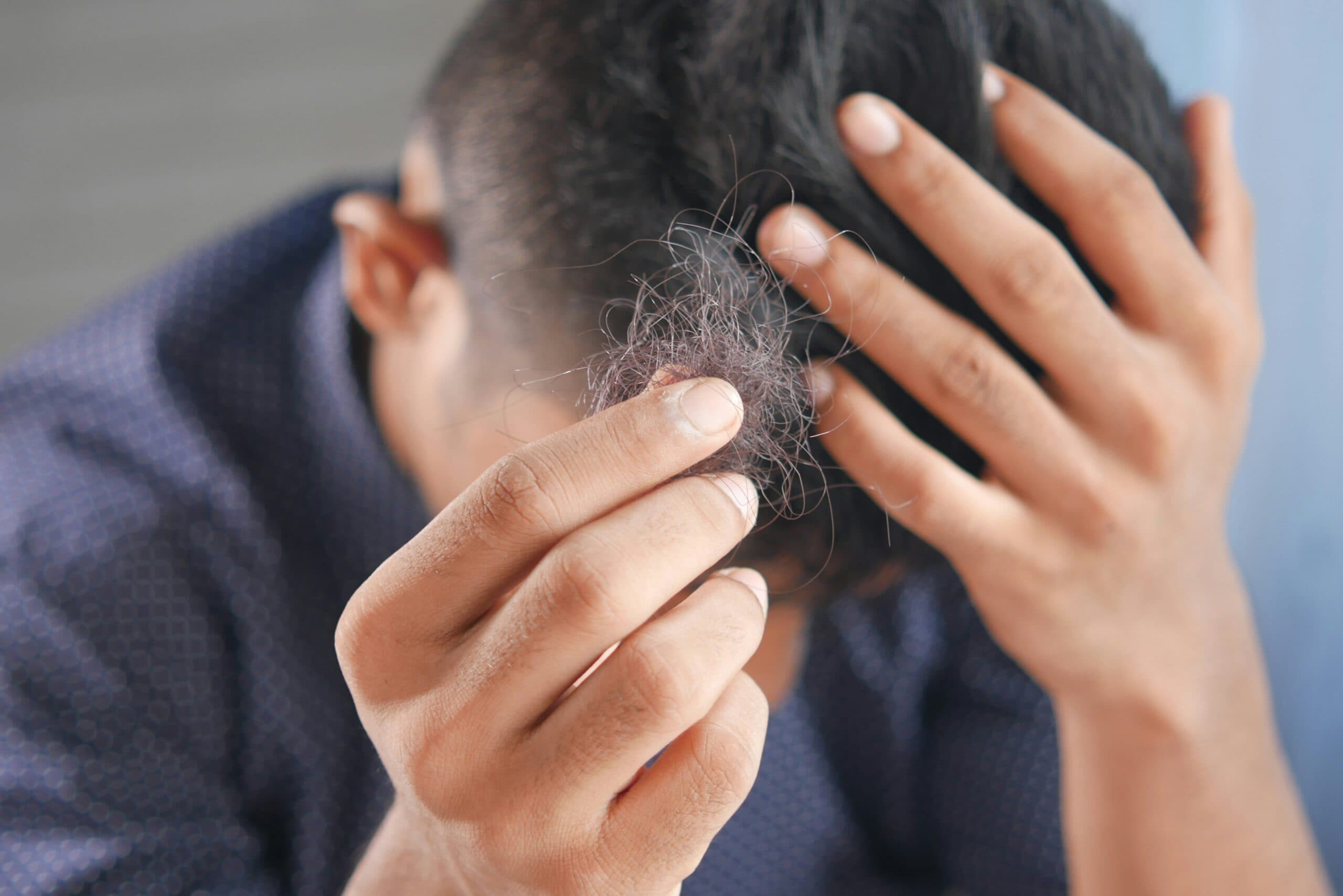 hair-loss-clinic-london