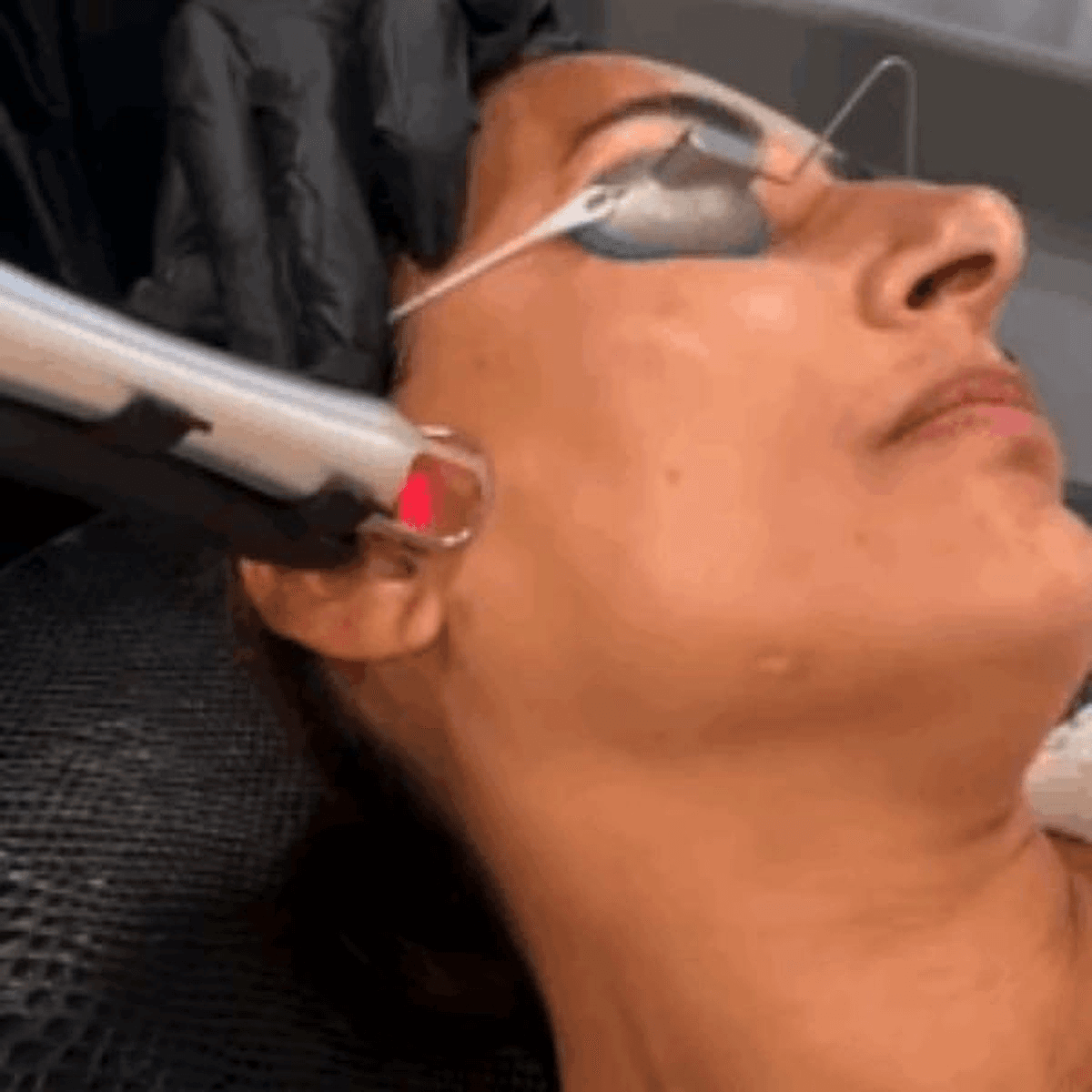 ultraclear-treatment