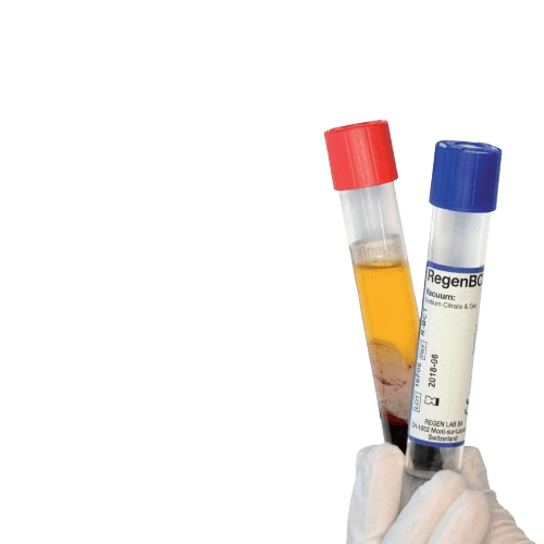 Regen-lab -PRP